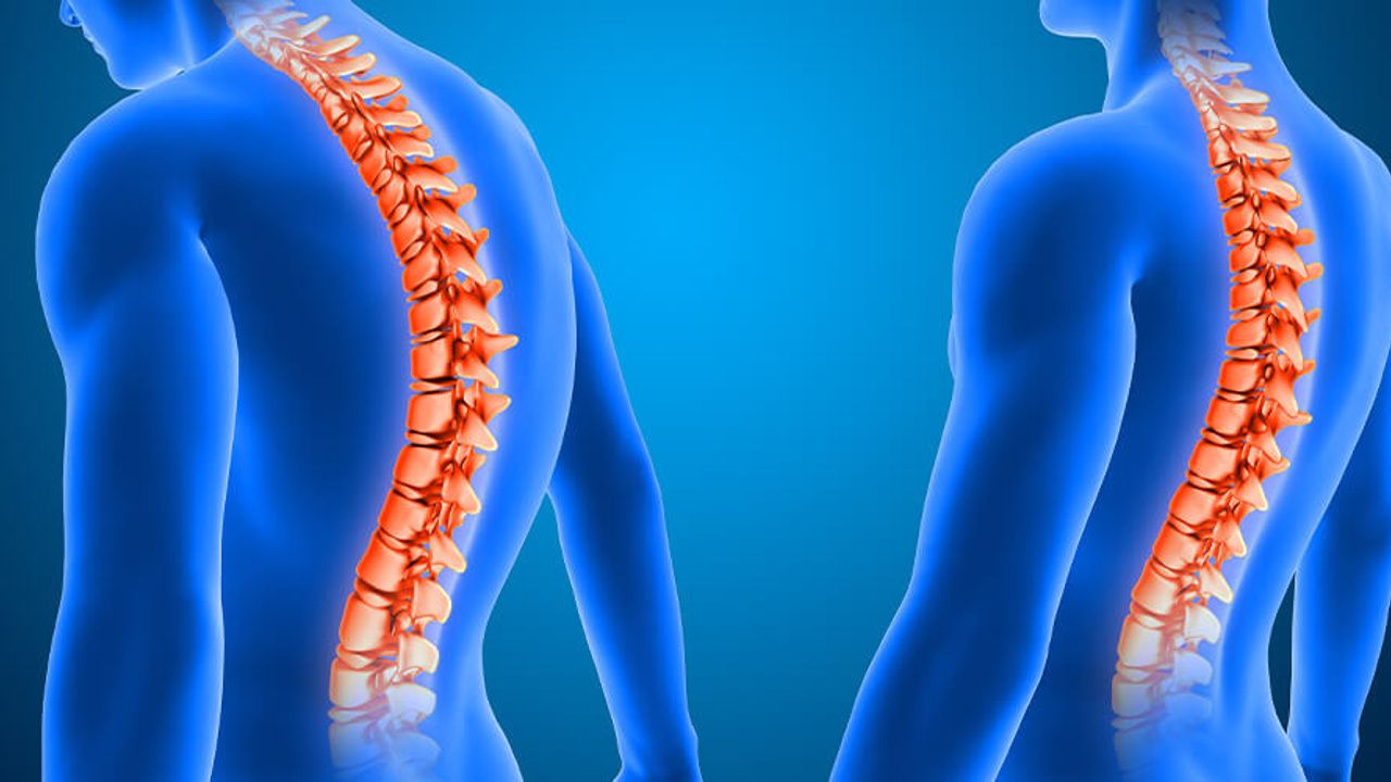 Selkärangan rappeuttavat sairaudet: miten ne tunnistaa ja milloin on syytä toimia.