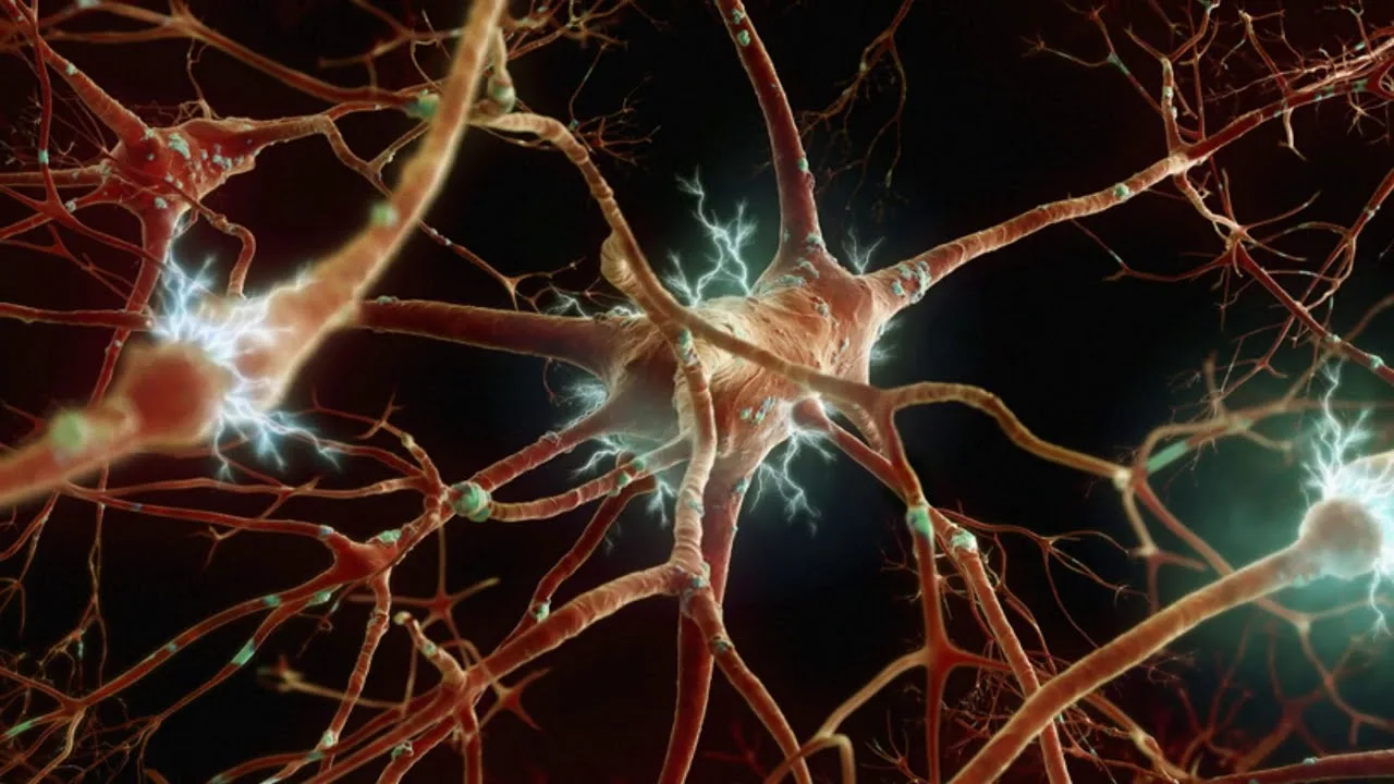 Neuronien suojakerroksen menetys voi johtaa aivojen viestinnän häiriöihin.