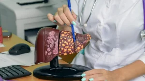 He varoittavat, että rasvainen ruokavalio muuttaa maksan solujen rakennetta ja lisää syövän riskiä.