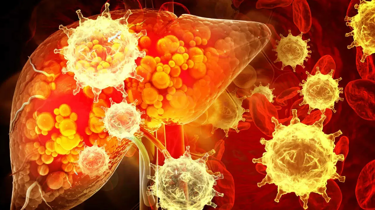 He varoittavat, että rasvainen ruokavalio muuttaa maksan solujen rakennetta ja lisää syövän riskiä.