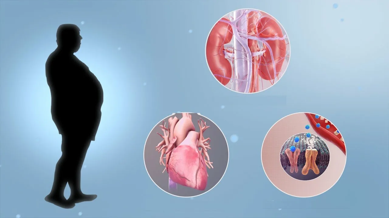 Mitkä ovat liikalihavuuden taustalla olevat biologiset tekijät ja miksi ne ovat avainasemassa tehokkaassa painonpudotuksessa?