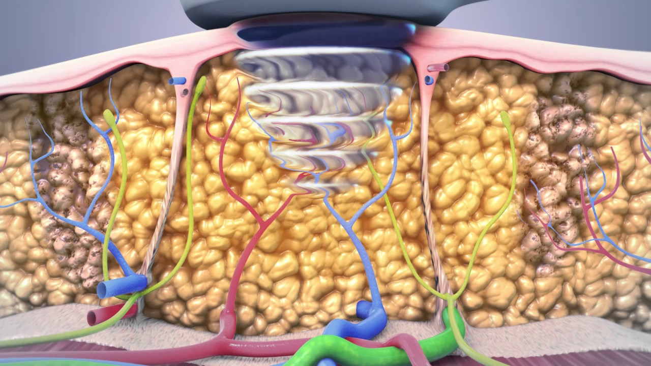 He selittävät, kuinka ruskea rasvakudos auttaa hallitsemaan verenpainetta.