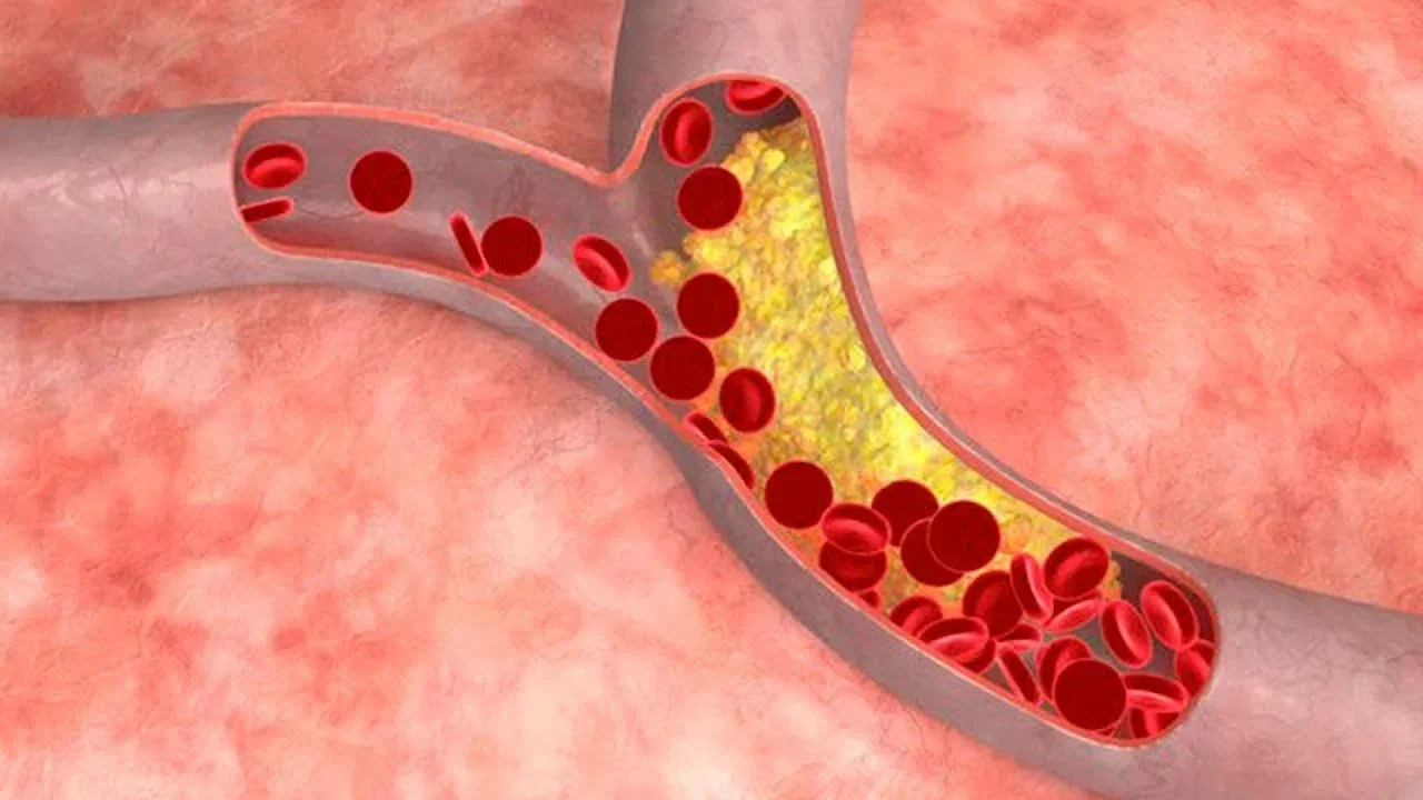 He selittävät, kuinka ruskea rasvakudos auttaa hallitsemaan verenpainetta.
